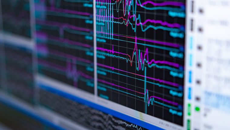 【事例】大手飲料メーカーの成功例　段階的検証と脳活動計測で機能性表示食品のエビデンスを可視化した方法とは
